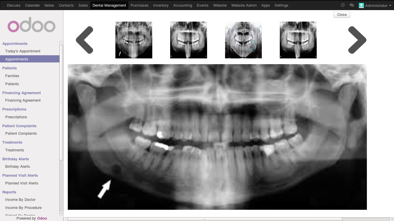 odoo dental management